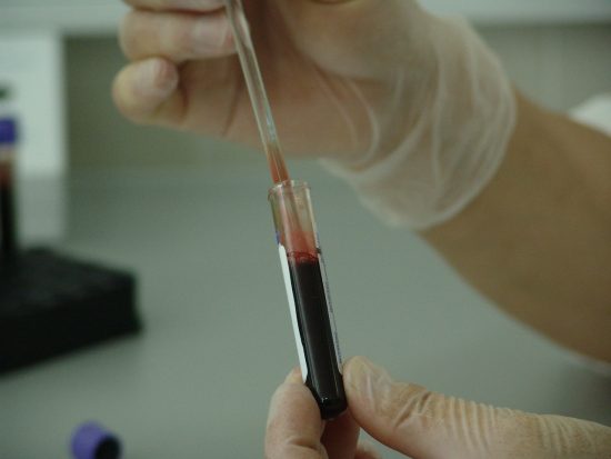 בדיקת דם פוריות