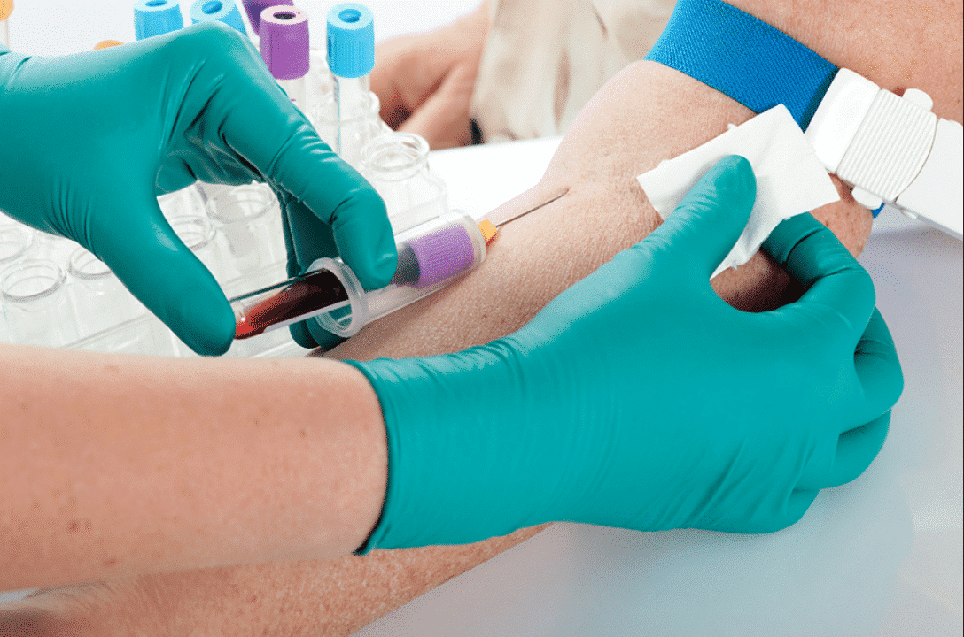 homebloodtest Human Testכל הבדיקות במקום אחד